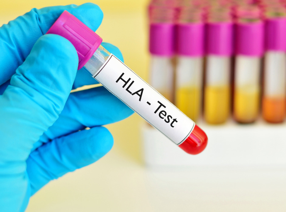 HLA型による親子鑑定