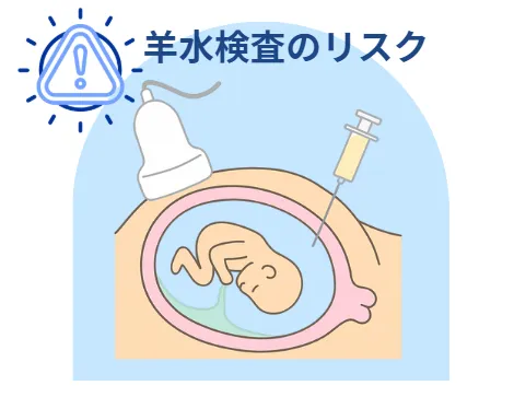 羊水検査のリスク