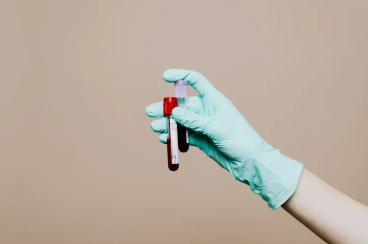 DNA鑑定の仕組みと流れ