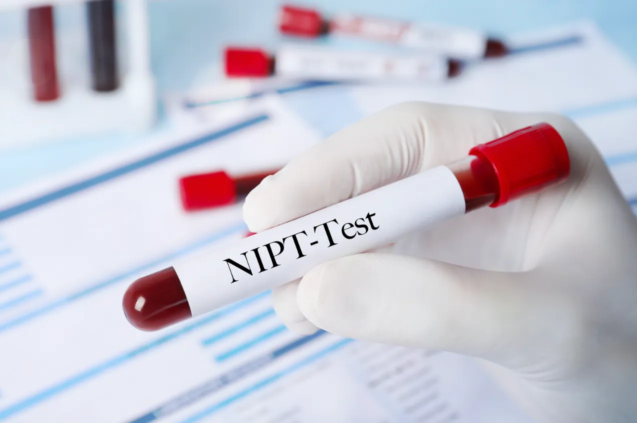 NIPTとは？検査の仕組みと安全性の理由